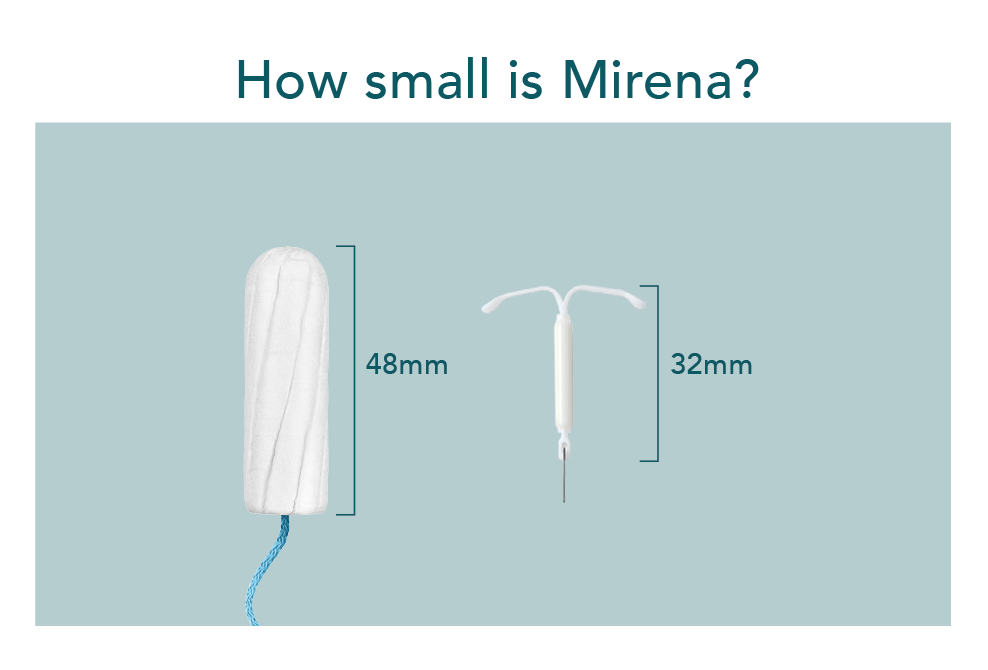 Mirena is a small t-shaped device that is placed in your uterus by a healthcare professional